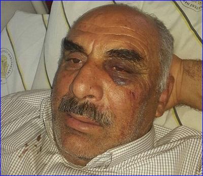 Iskandar Dayan, an Assyrian farmer in south-east Turkey who was attacked by Kurds, in hospital.